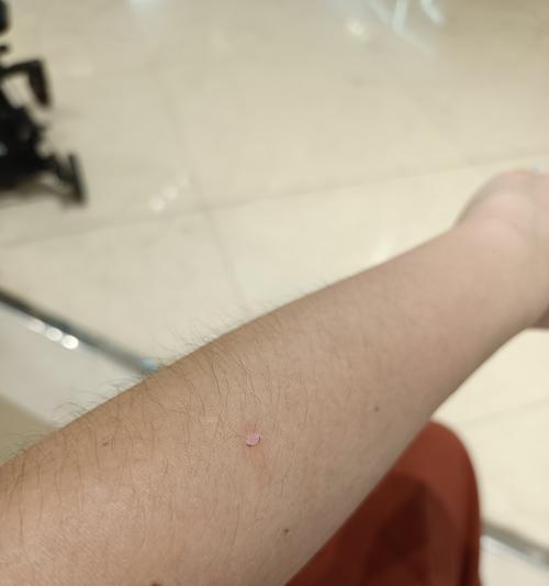 春季哪些植物会脱皮？脱皮现象的原因和处理方法是什么？