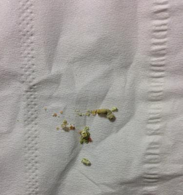 玉米幼苗叶子发黄是怎么回事？如何预防和治疗？
